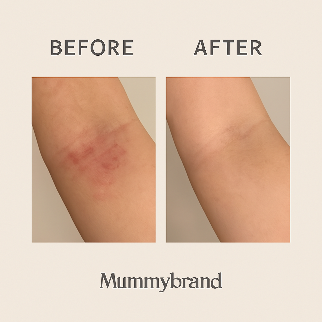 Mummybrand Skin Reset Wet & Dry Wraps (2 Pairs)