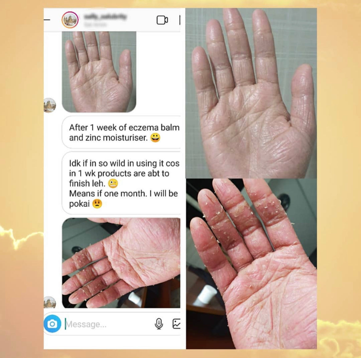 Barrier+ Intensive Jelly - 120g (Formerly Pro Jelly)