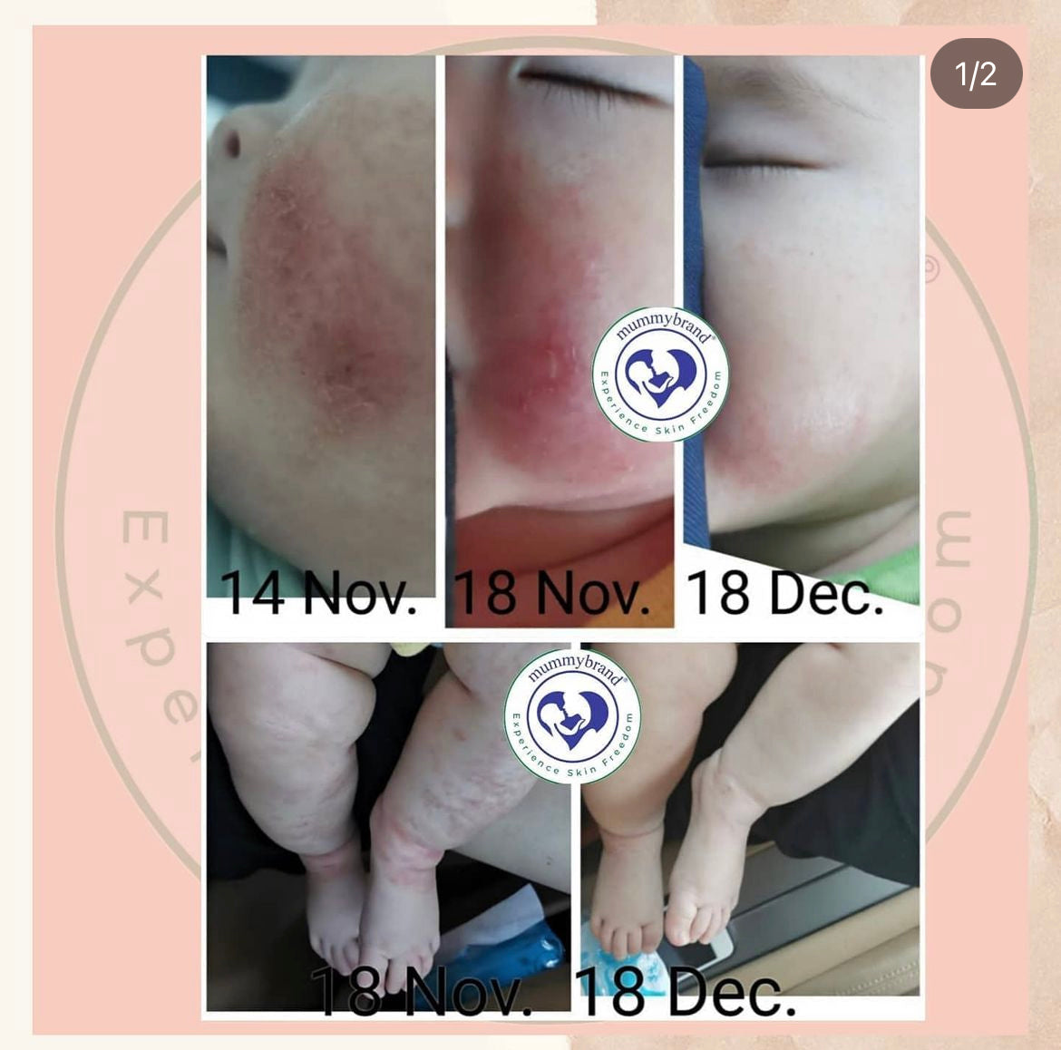 Z-Advanced Moisturiser - For Itchy & Discomfort Skin (200g)