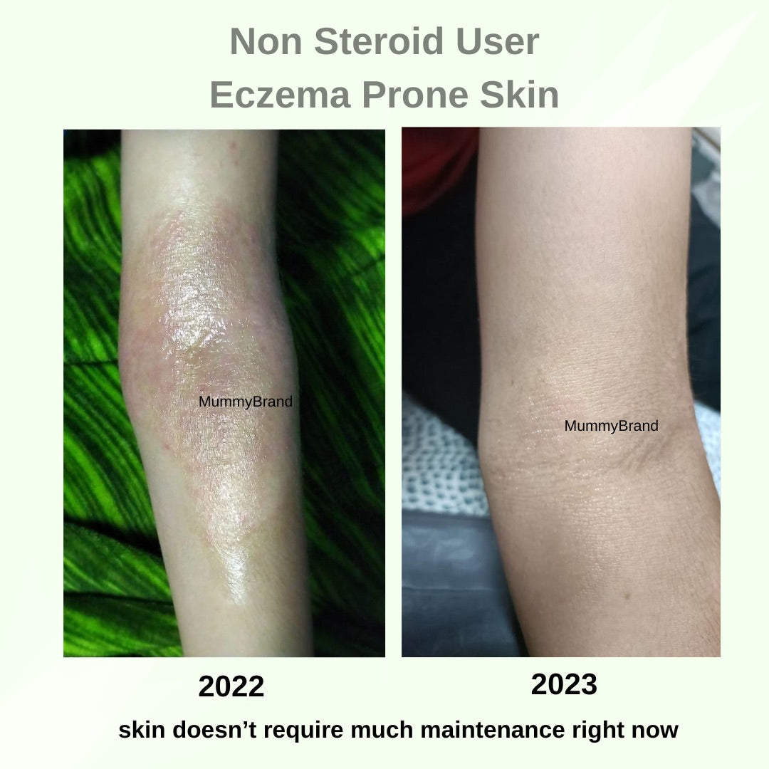 Barrier+ Intensive Kit (Formerly Hypersensitive Skin Kit)