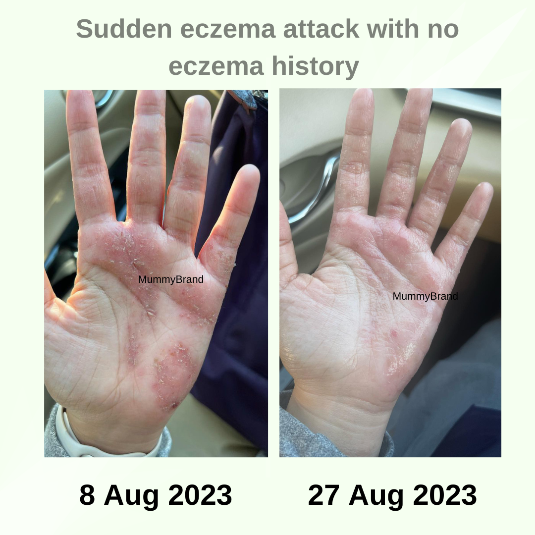 Z-Advanced Pro Jelly For Chronic Sensitive Skin (120g)