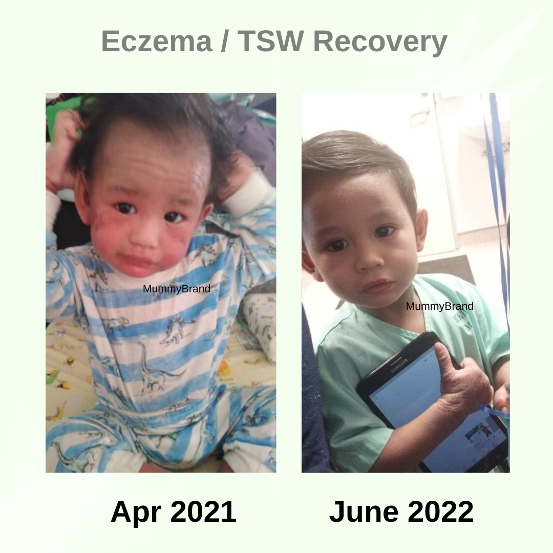 Barrier+ Intensive Kit (Formerly Hypersensitive Skin Kit)