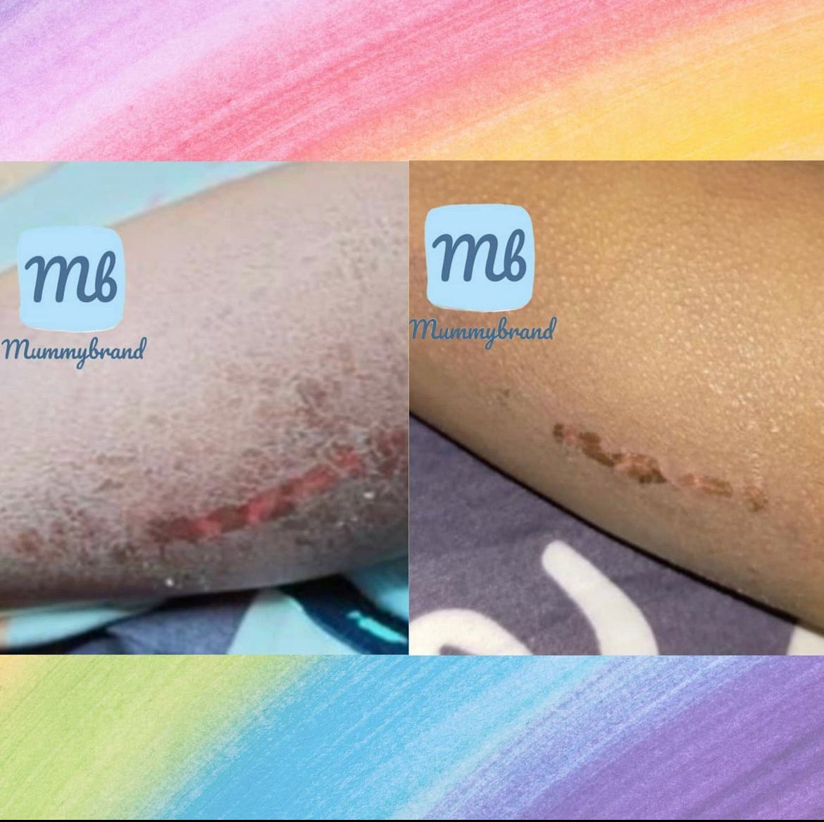 [MID MAY 2025] Z-Advanced Pro Jelly For Chronic Sensitive Skin (120g)