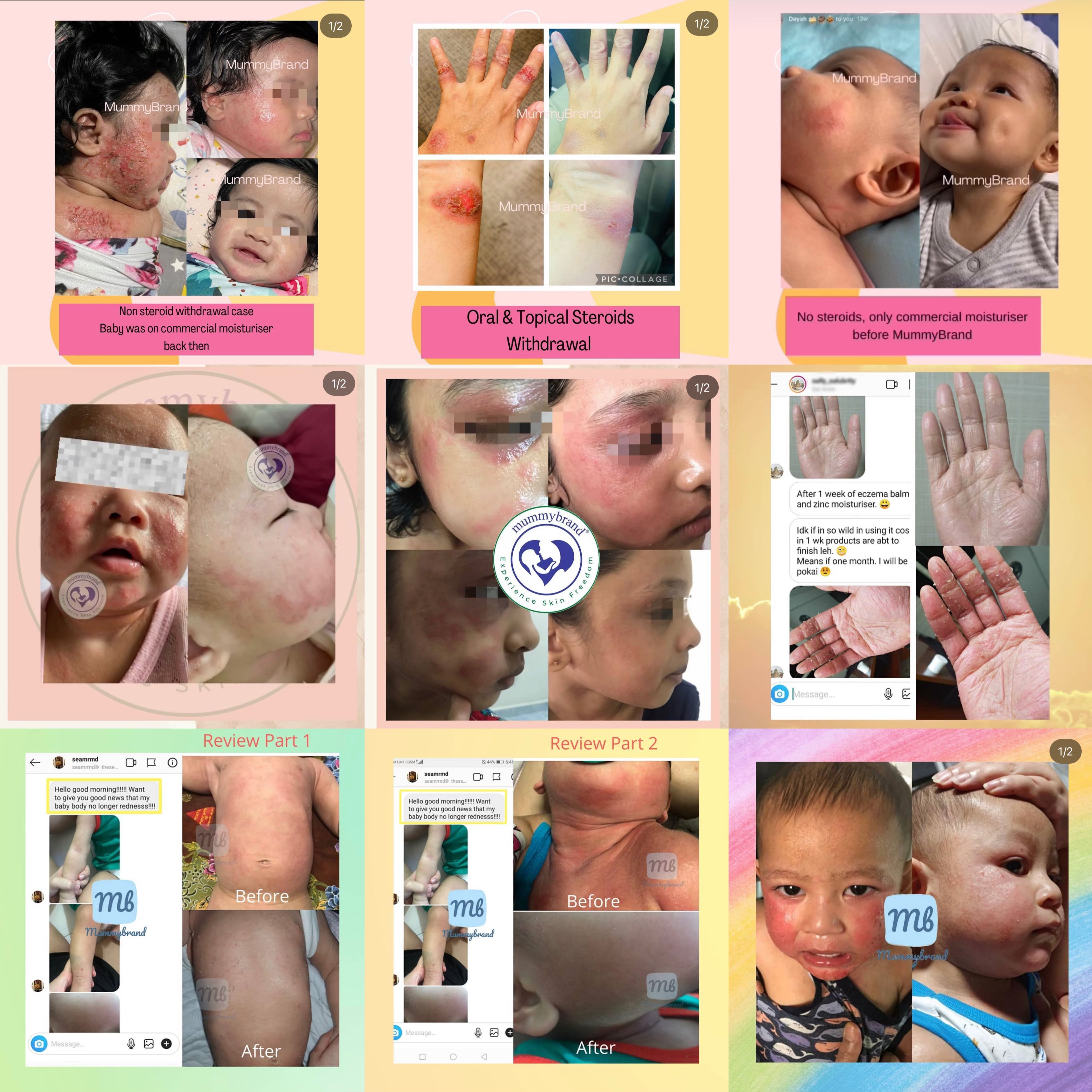 The Hyper-Sensitive Skin Kit